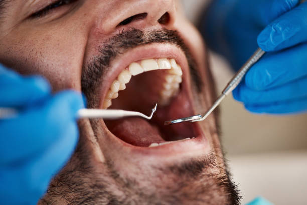 Best Emergency Dentist for Knocked-Out Tooth in New Concord, OH